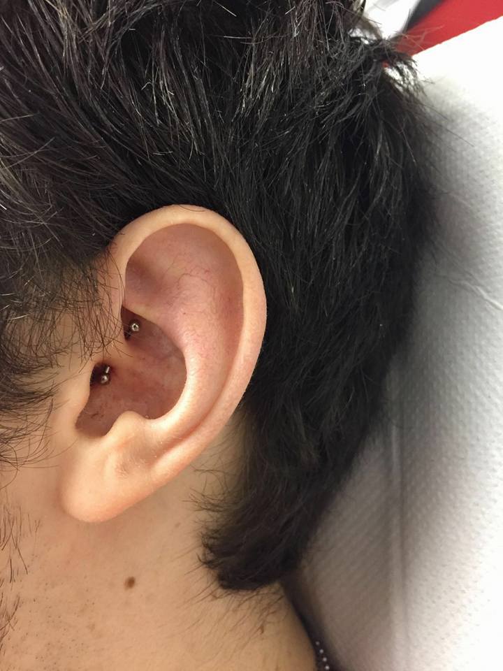 Can The Daith Piercing Help Migraines Pictures Of Lily